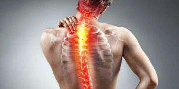 picture of a misaligned spine