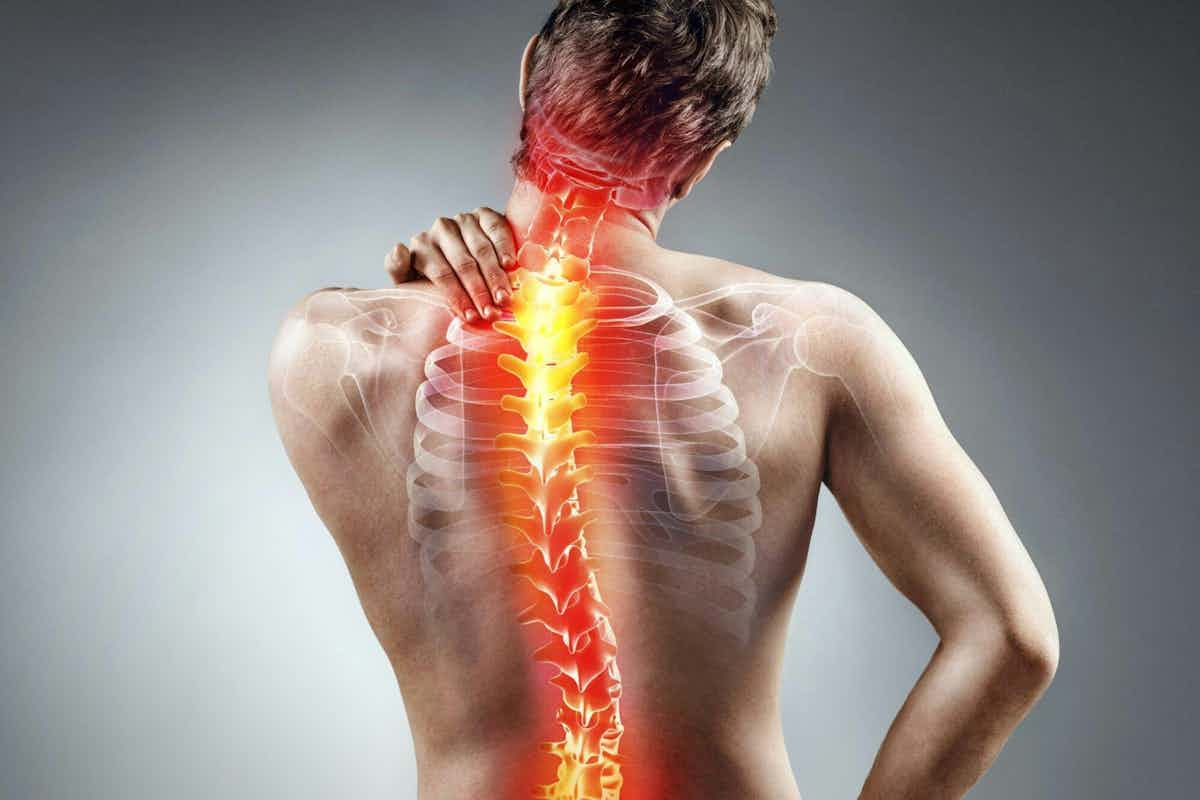 picture of a misaligned spine